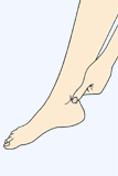 足のむくみのツボ療法３